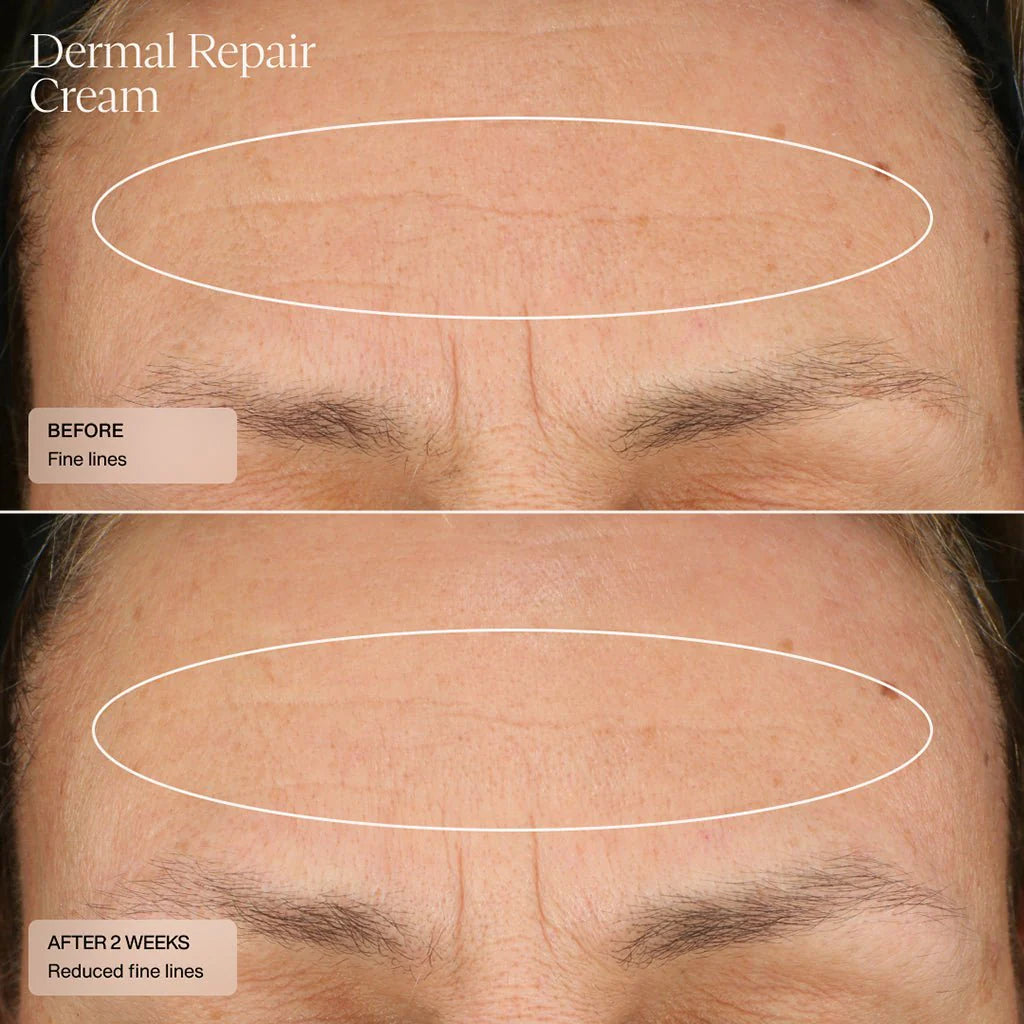 Dermal Repair Cream