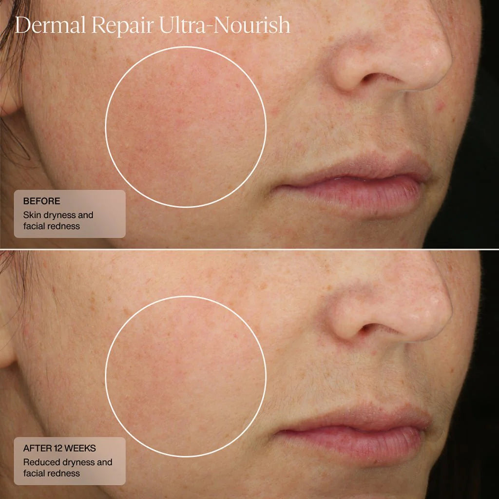 Dermal Repair Ultra-Nourish