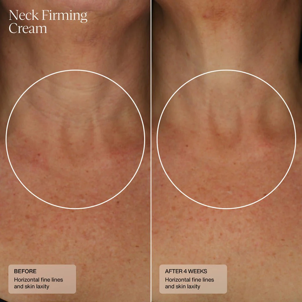 Neck Firming Cream