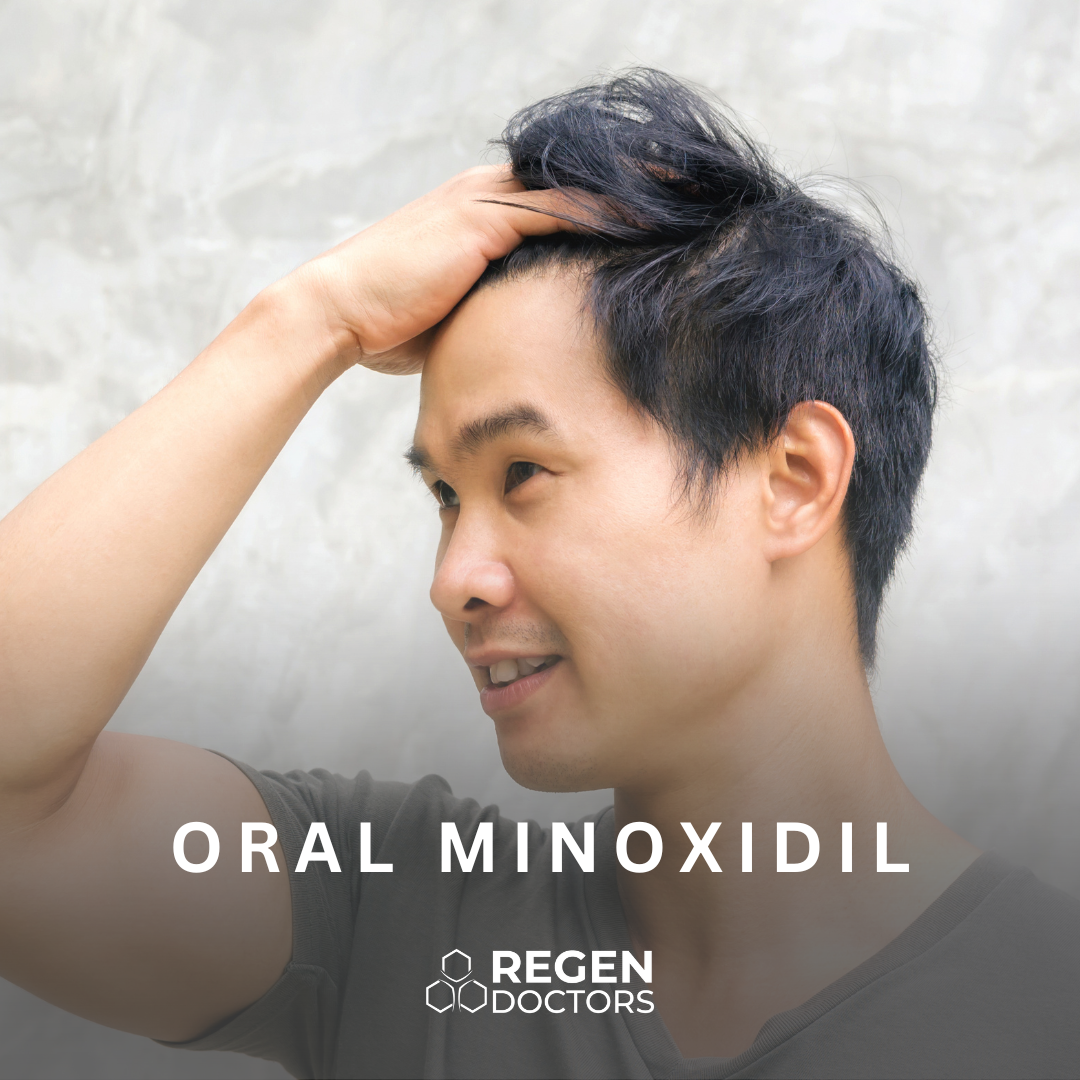 Oral Minoxidil 2.5 mg (Month Supply)